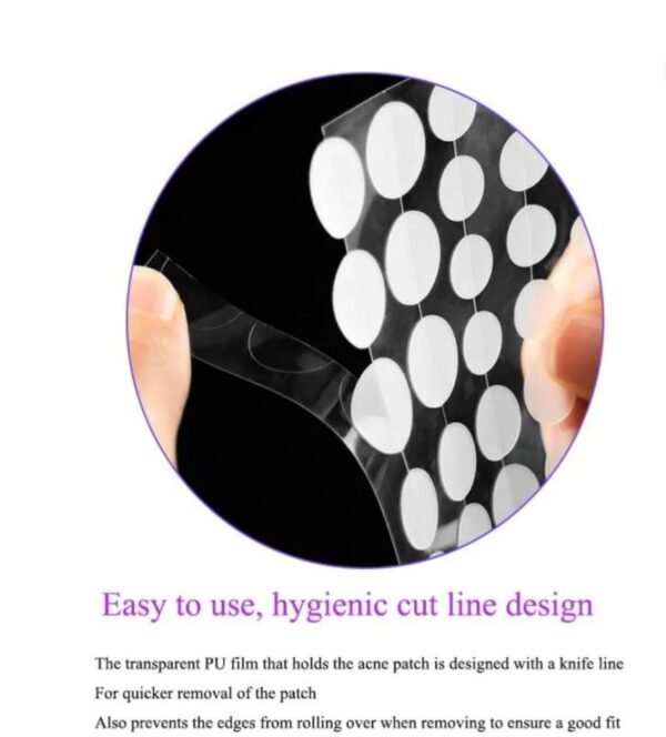 Acne Spot Patches – Invisible Hydrocolloid Blemish Treatment - Image 5