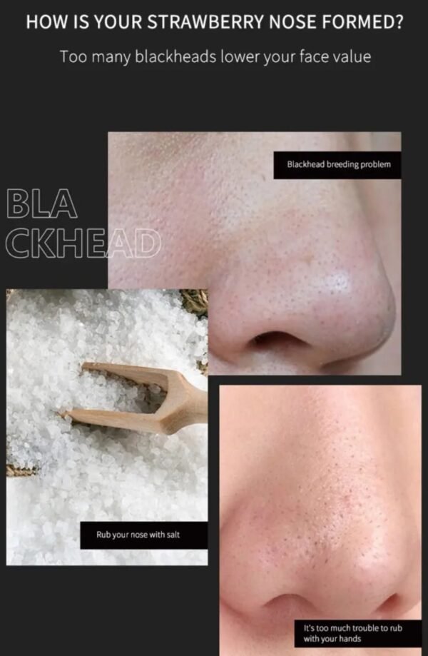Nose Blackhead & Whitehead Removal Pore Shrinking Mask Patch - Image 6