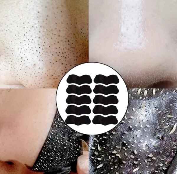 Nose Blackhead & Whitehead Removal Pore Shrinking Mask Patch - Image 3
