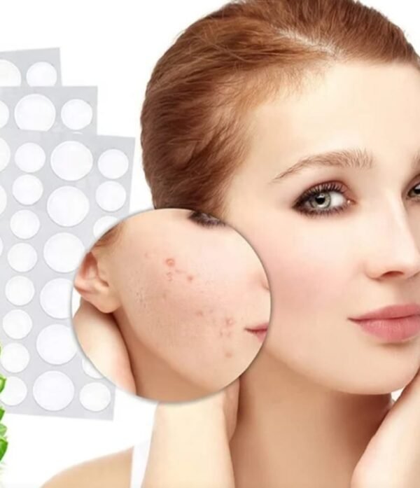 Acne Spot Patches – Invisible Hydrocolloid Blemish Treatment
